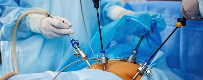 Laparoscopic Surgery in Cancer - Dr. Saneya Pandrowala