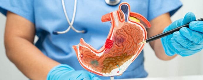 Stomach Cancer - Dr. Saneya Pandrowala