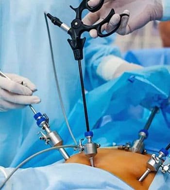 Laparoscopic Surgery in Cancer treatment in Thane